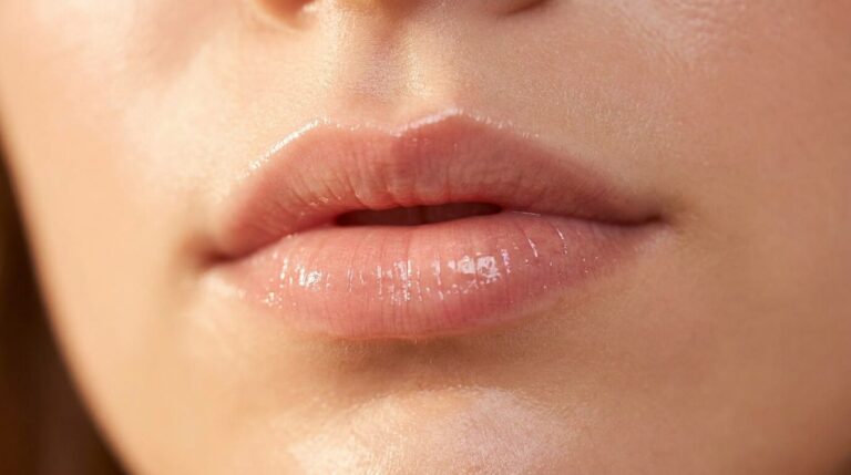 Labios con relleno excesivo vs labios con volumen natural y elegante, estetica facial